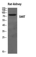 SMIT Polyclonal Antibody