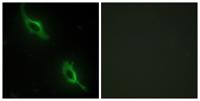 sMtCK Polyclonal Antibody