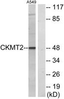 sMtCK Polyclonal Antibody