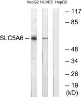 SMVT Polyclonal Antibody