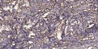 SMVT Polyclonal Antibody