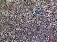 ALDH1A1 Polyclonal Antibody