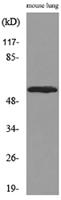 ALDH1A1 Polyclonal Antibody