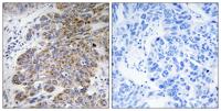 HNK-1ST Polyclonal Antibody