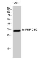 hnRNP C1/2 Polyclonal Antibody