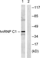 hnRNP C1/2 Polyclonal Antibody