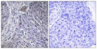 hnRNP DL Polyclonal Antibody