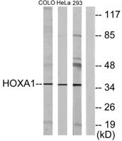 Hox-A1 Polyclonal Antibody