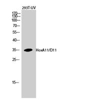 HoxA11/D11 Polyclonal Antibody