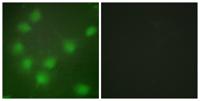 HoxA11/D11 Polyclonal Antibody