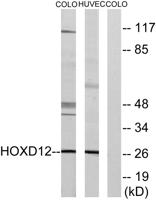 HoxD12 Polyclonal Antibody