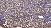 HRI Polyclonal Antibody