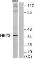 HRT2 Polyclonal Antibody