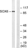 Sox-6 Polyclonal Antibody