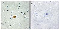 Sox-8/9/17/18 Polyclonal Antibody