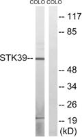 SPAK Polyclonal Antibody