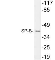 SP-B Polyclonal Antibody