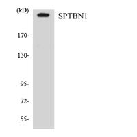 Spectrin β II Polyclonal Antibody