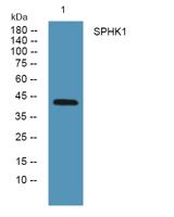 SPHK1 Polyclonal Antibody