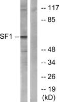 Splicing factor 1 Polyclonal Antibody