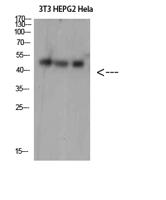 SPOP Polyclonal Antibody