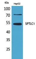 SPTLC1 Polyclonal Antibody