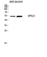 SPTLC1 Polyclonal Antibody