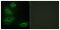 SR-1B Polyclonal Antibody