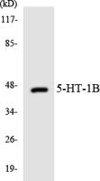 SR-1B Polyclonal Antibody