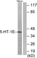 SR-1E Polyclonal Antibody