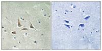 HSF-27 Polyclonal Antibody