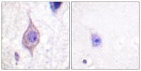 ALK Polyclonal Antibody