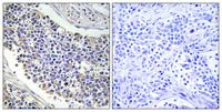 Aldose Reductase Polyclonal Antibody