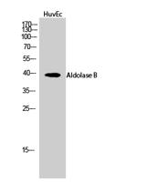 Aldolase B Polyclonal Antibody