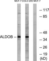 Aldolase B Polyclonal Antibody