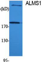 ALMS1 Polyclonal Antibody