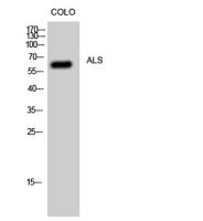 ALS Polyclonal Antibody