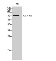 ALS2CR11 Polyclonal Antibody