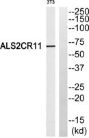 ALS2CR11 Polyclonal Antibody