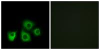 Olfactory receptor 5M1/5M10 Polyclonal Antibody