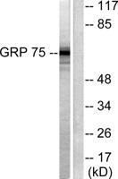 HSP A9 Polyclonal Antibody