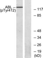 Abl1/2 (phospho Tyr393/439) Polyclonal Antibody