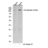 ACK (phospho Tyr284) Polyclonal Antibody