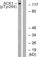 ACK (phospho Tyr284) Polyclonal Antibody