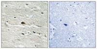 HMG-14 (phospho Ser21) Polyclonal Antibody