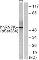 hnRNP K (phospho Ser284) Polyclonal Antibody