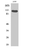 Hrs (phospho Tyr216) Polyclonal Antibody