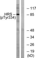 Hrs (phospho Tyr334) Polyclonal Antibody