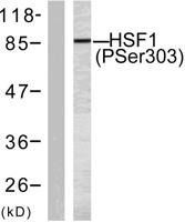 HSF1 (phospho Ser303) Polyclonal Antibody