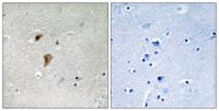 HSF1 (phospho Thr142) Polyclonal Antibody